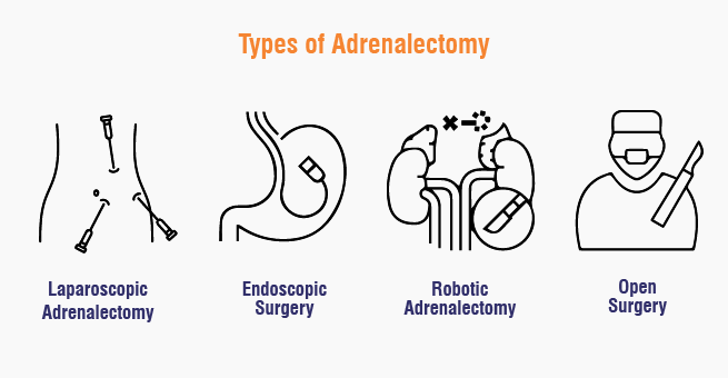 Adrenalectomy Types 