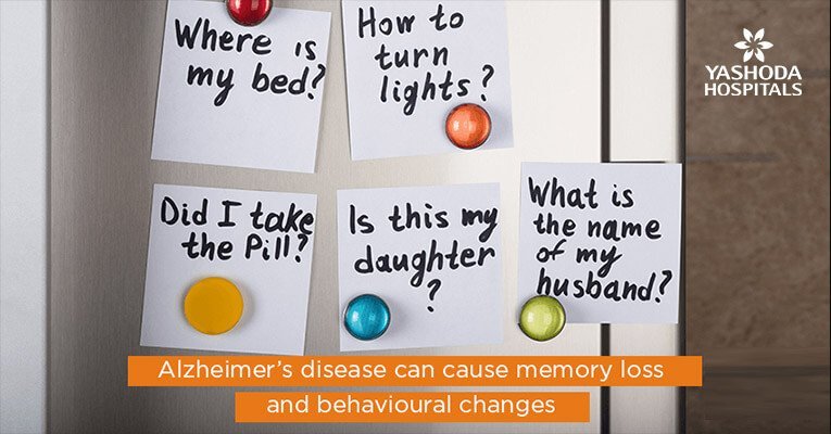 Alzheimer’s disease can cause memory loss and behavioural changes