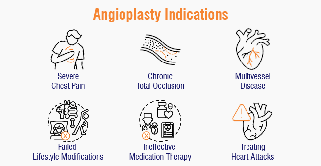 Angioplasty indications