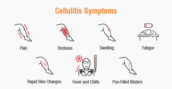 Cellulitis symptoms