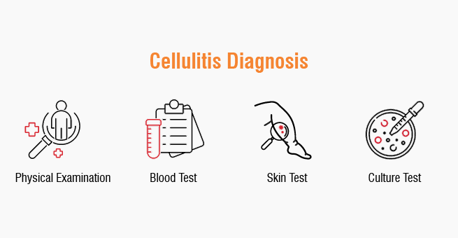 Cellulitis diagnosis