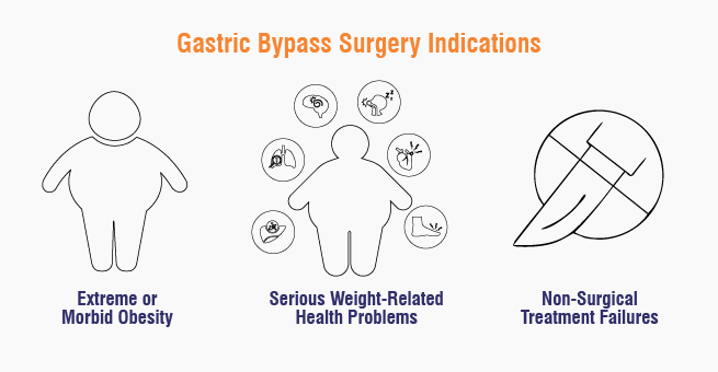 Gastric Bypass Surgery indications