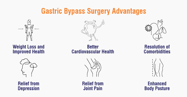 Gastric Bypass Surgery Advantages