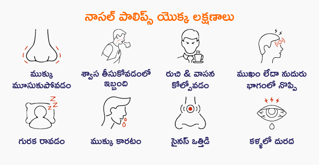 Nasal Polyps Symptoms telugu