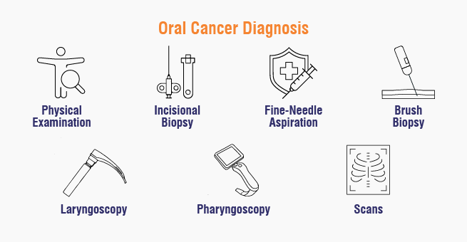 Oral Cancer Diagnosis