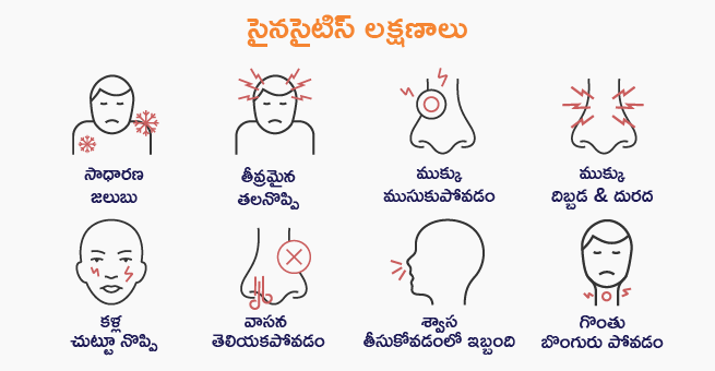 Sinusitis (Sinus Infection)_symptoms