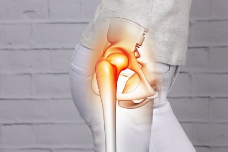 Slipped Capital Femoral Epiphysis and it's Causes