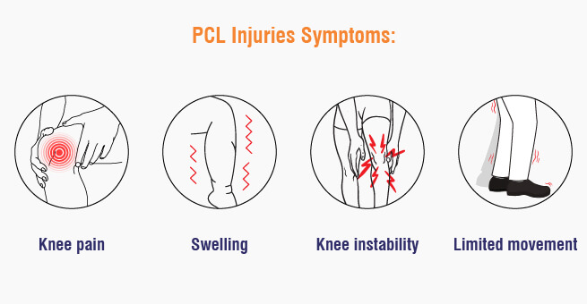 Understanding PCL Injuries_Body 1