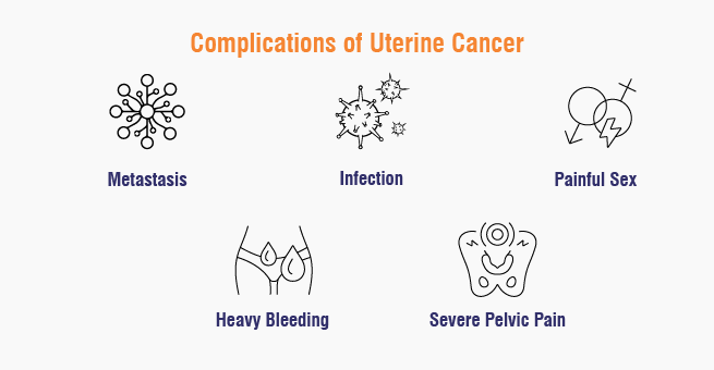 Complications of Uterine Cancer