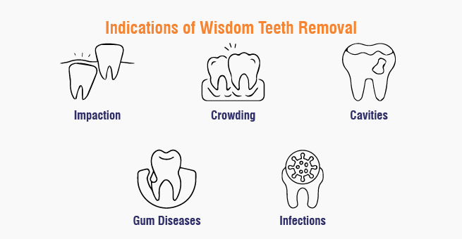 Wisdom Teeth Removal indications