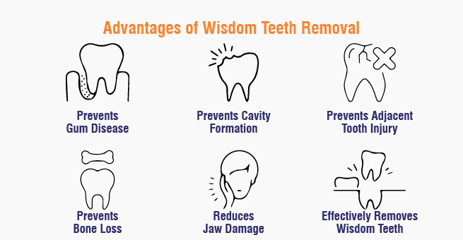 Wisdom Teeth Removal Advantages