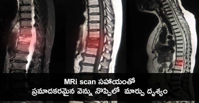 diagnose-facet-joint-arthropathy 